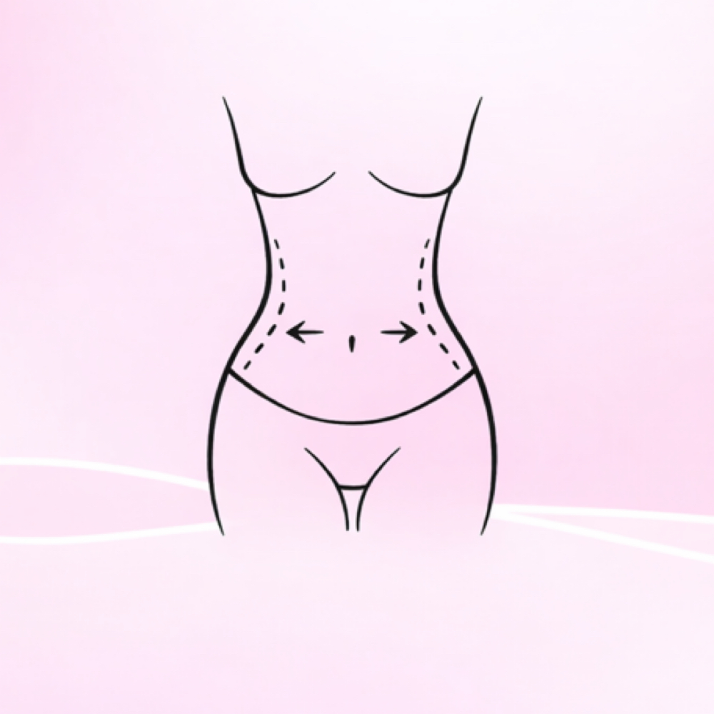 Fat Dissolver (PCDC) at Pinnacle Beauty in Lubbock, TX