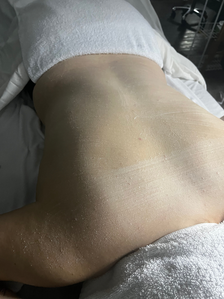 Back Treatment at Chic Claws in Chicago, IL