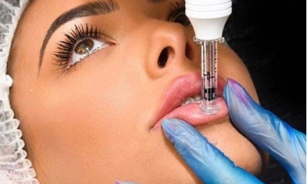 Needle-less Lip Filler