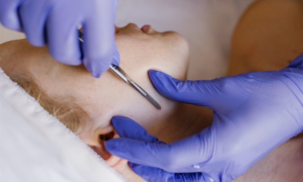 Dermaplanning Facial