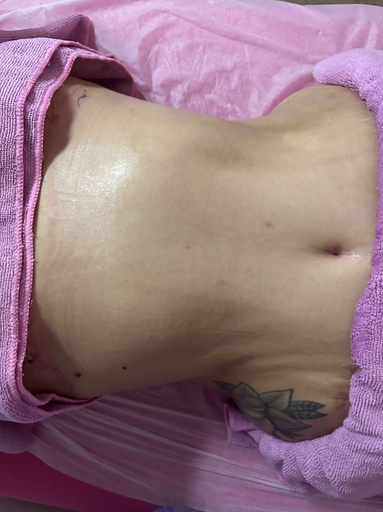 Snatched Combo Stomach And Booty