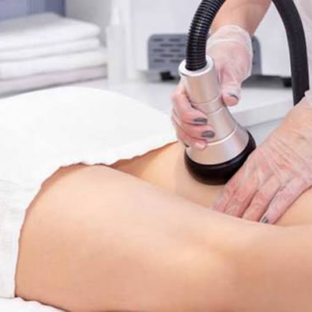 RF Vacuum Negative Pressure at Sculpting Beauty by Pam LLC in Atascocita, TX