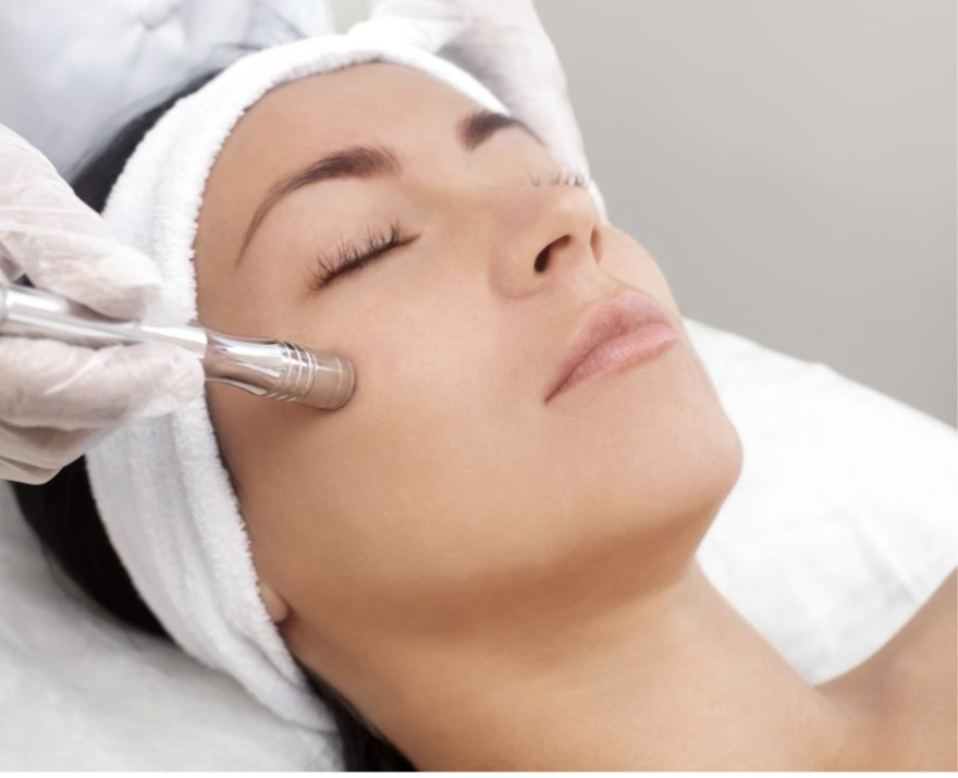 Microdermabrasion