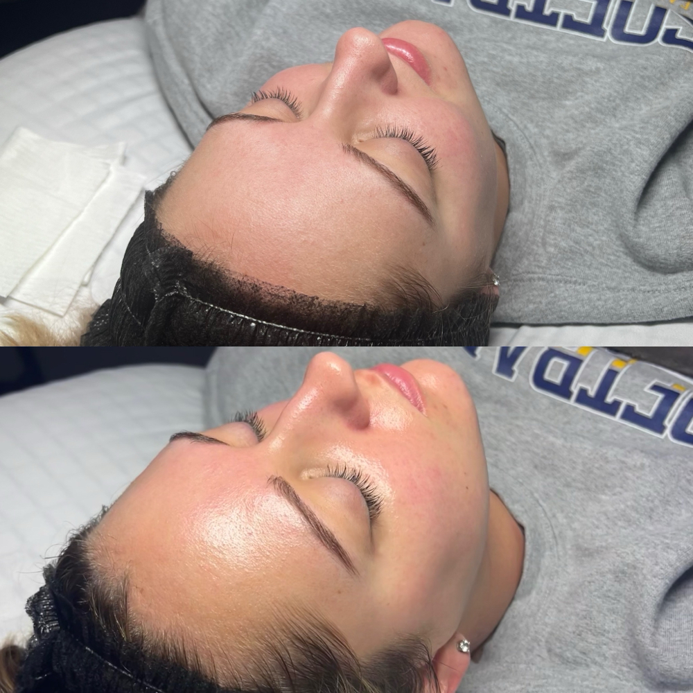 Deep Clean Facial at Raine Esthetics in Pendleton, IN