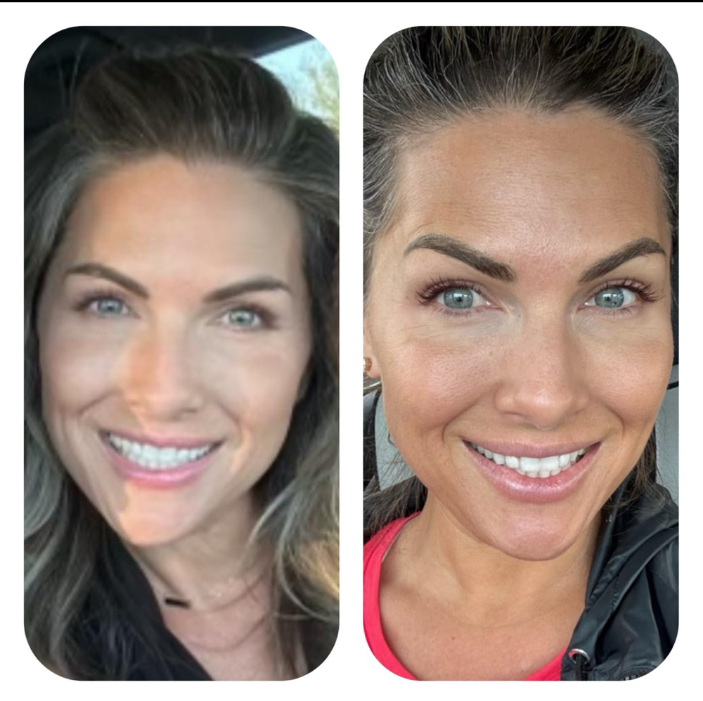 Add A Glow