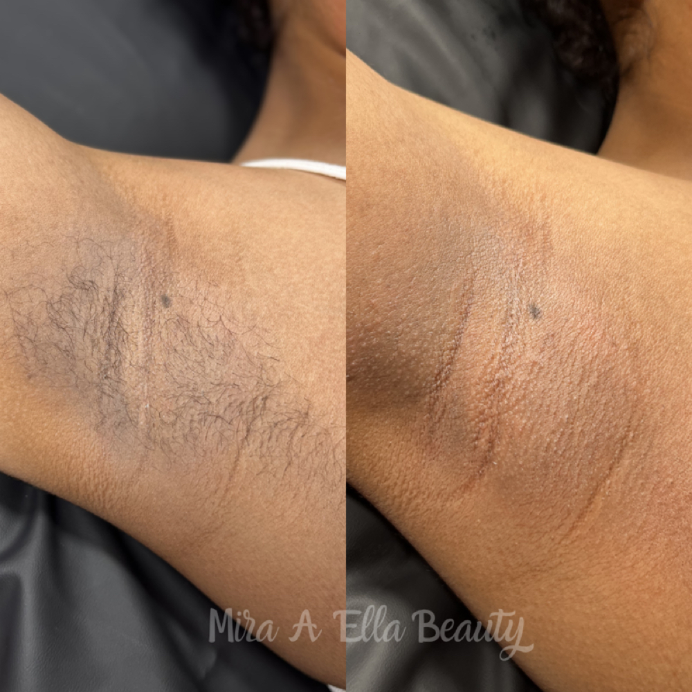 Underarm Wax at JA Beauty & Skin in Kansas City, MO
