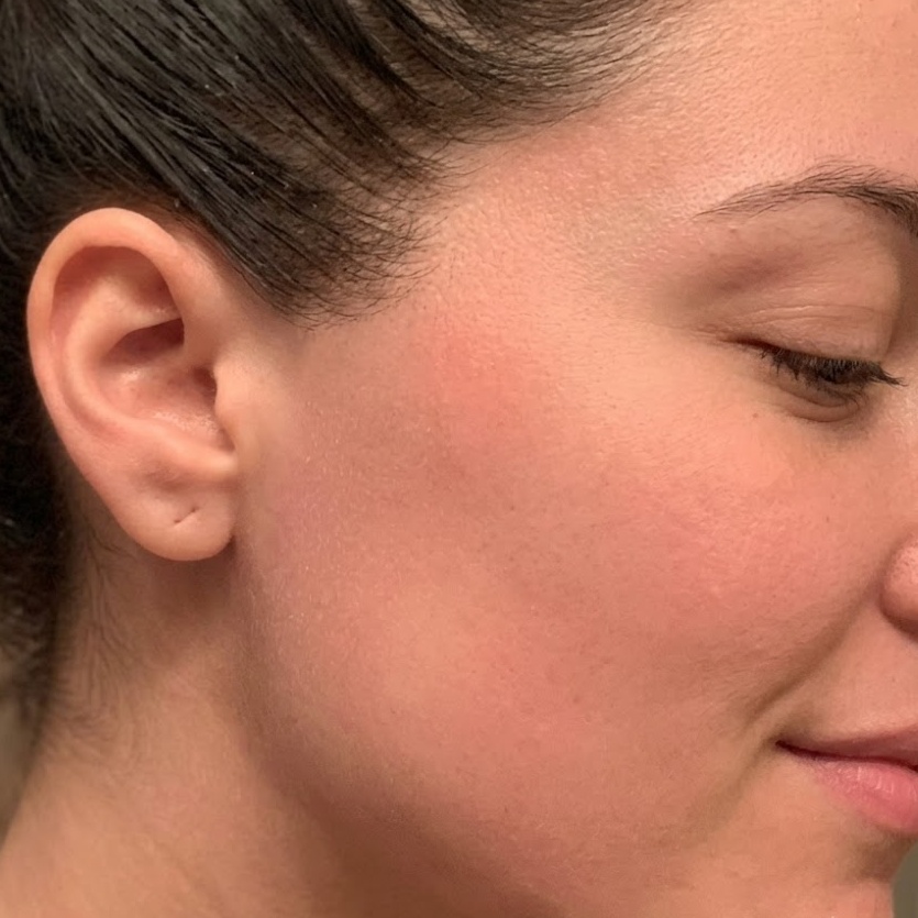 Side Burns at SUSH Skin Studio And Spa in Covington, WA