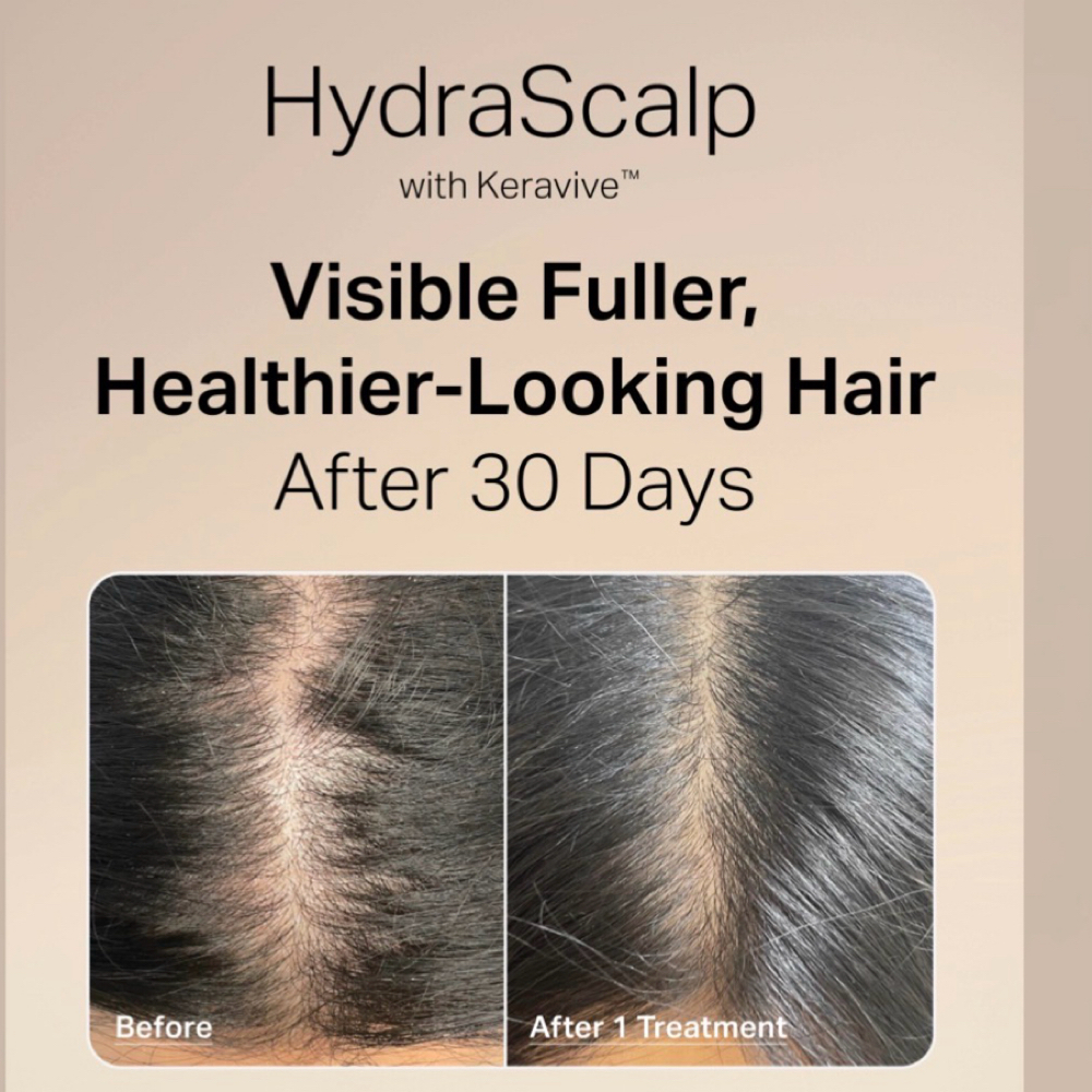 HydraScalp Keravive at Skincare by Beth LLC in Winter Garden, FL