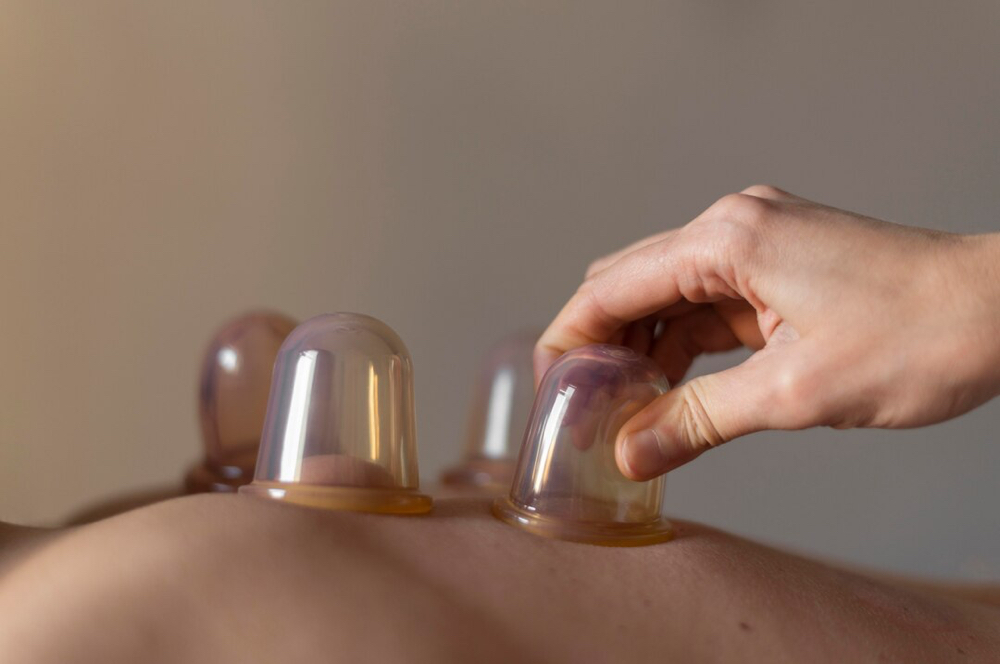 Cupping 90 Min at Joyful Therapies in Charlotte, NC