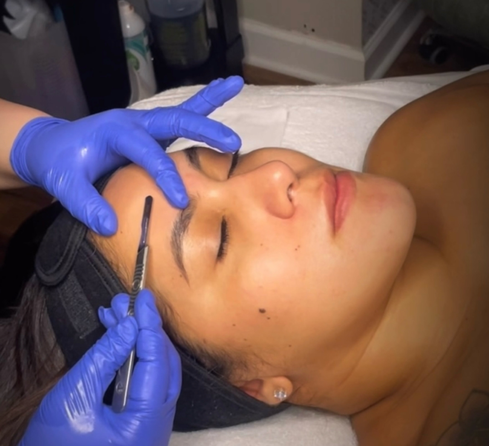 Dermaplane Facial