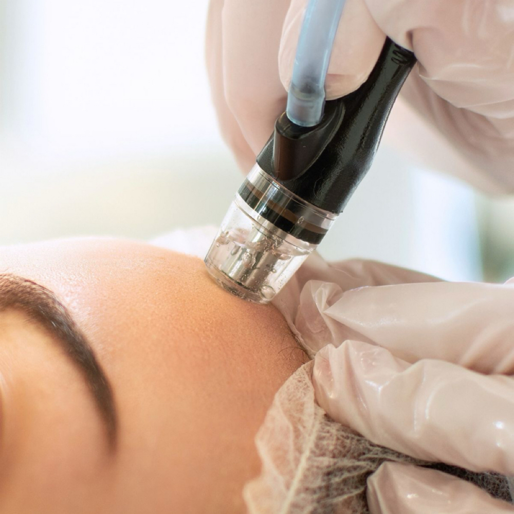 Hydrafacial at Skin By Carly in LaFayette, GA