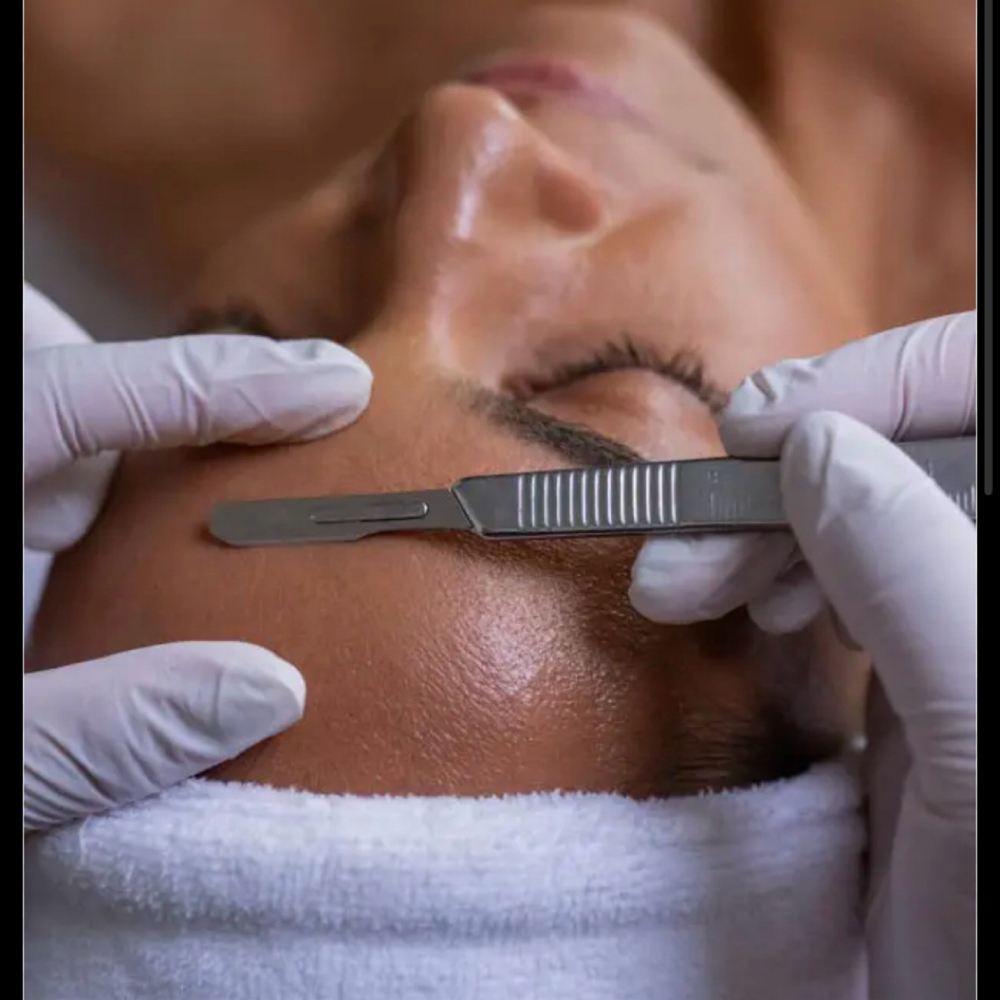 Dermaplaning (Solo, Without Facial) at McLees Bodywork & Skin in Asheville, NC