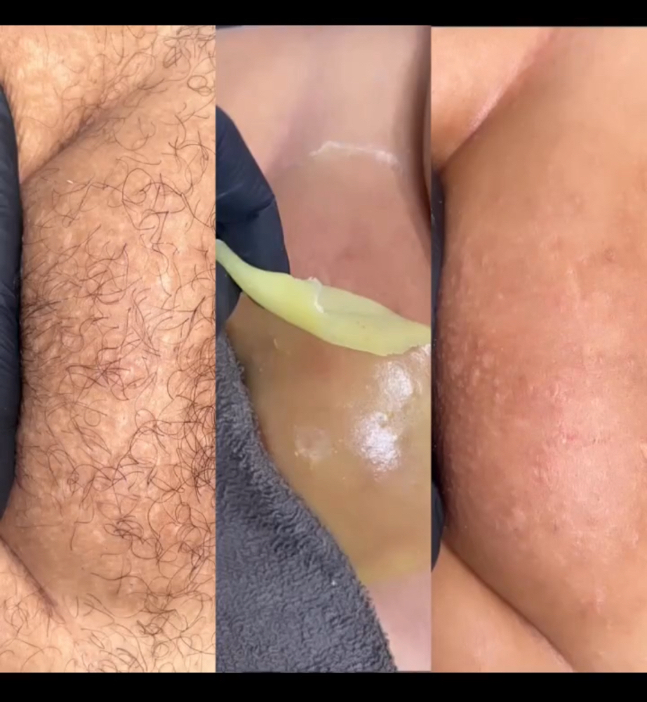 Brazilian+Vajacial