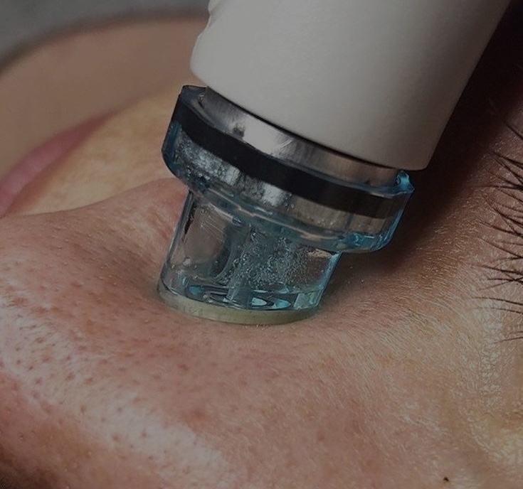 Signature Hydrafacial MD