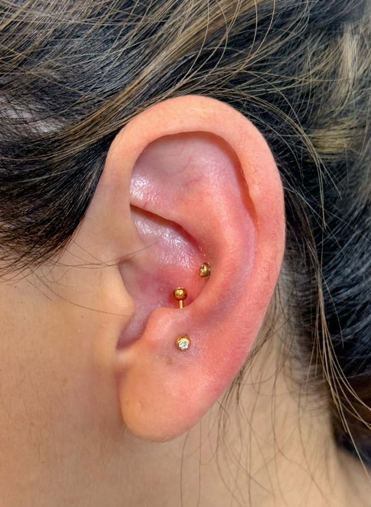 Anti-tragus