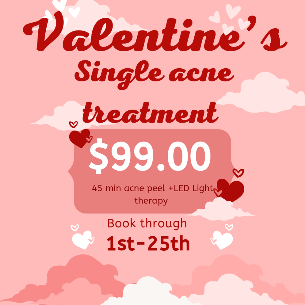 Valentines Acne Treatment