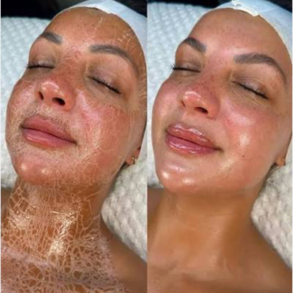 Beyond Botox Peptide Firming Mask