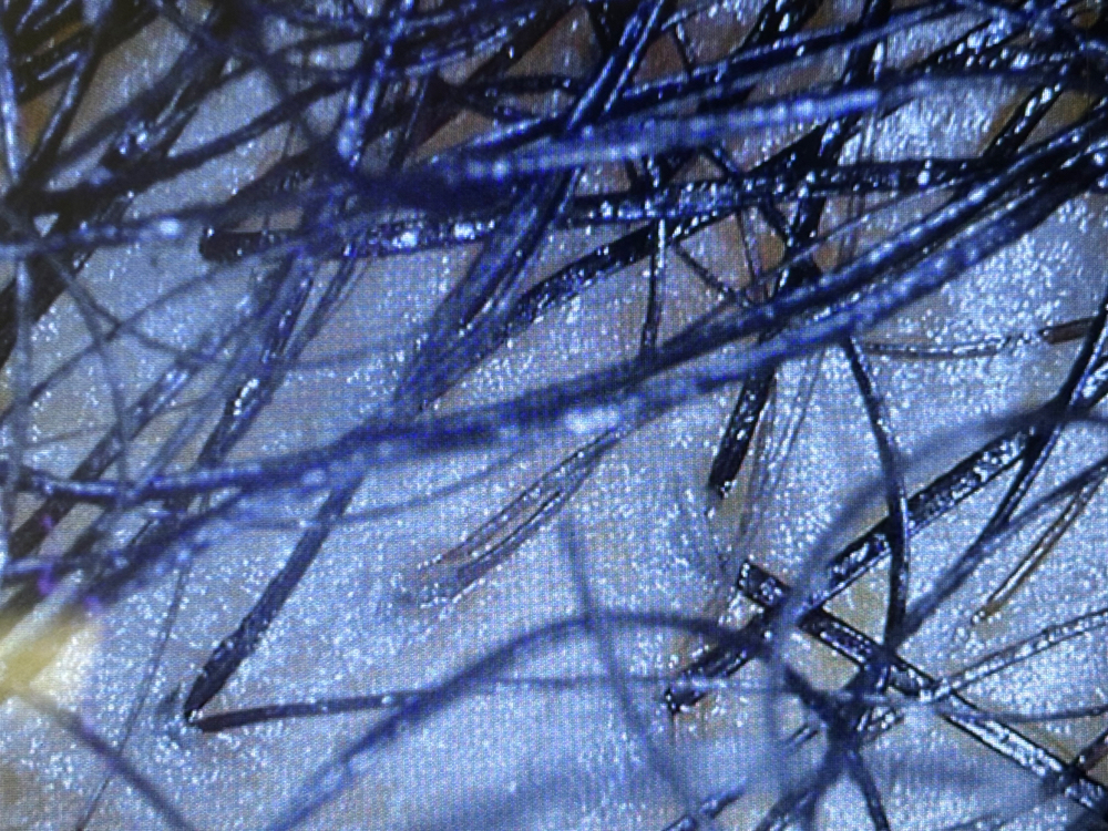 ScalpScope™ Analysis