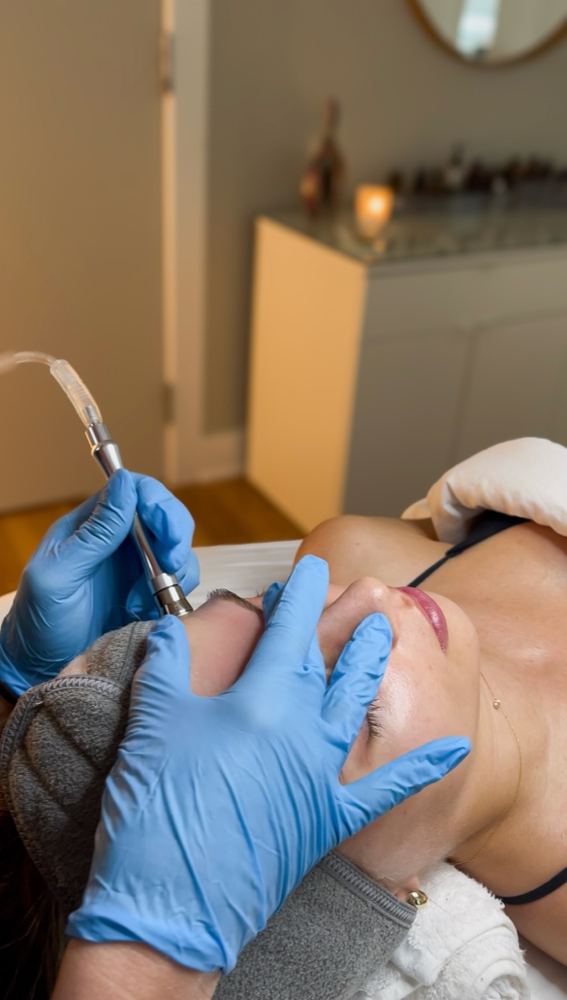 Microdermabrasion