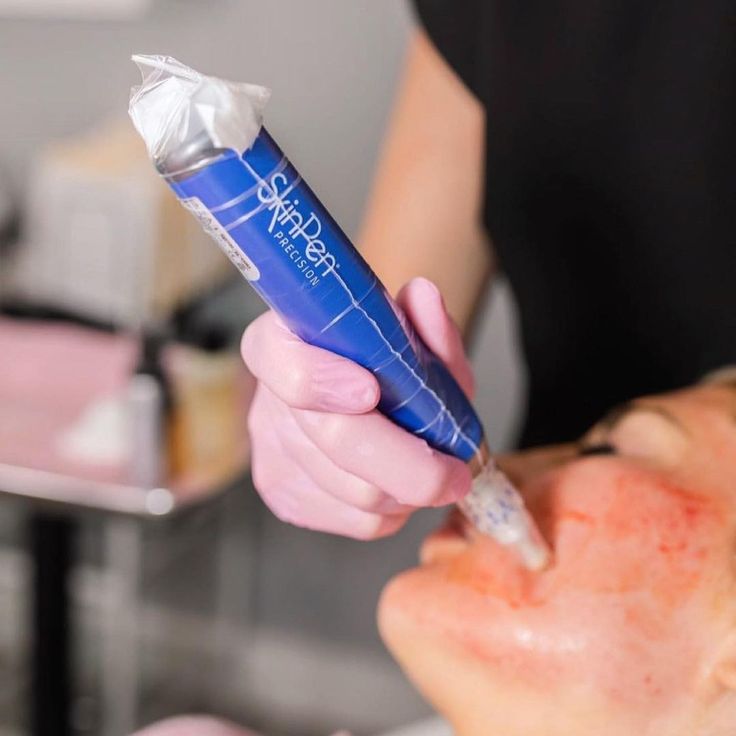 Microneedling Packages Available
