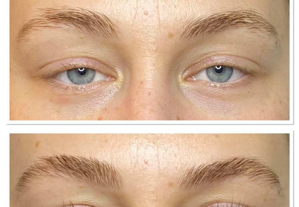 Brow Lamination