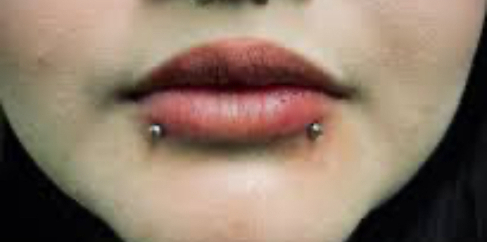 Snake Bite at Lasting Impressions LHC in Lake Havasu City, AZ