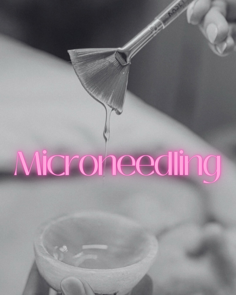 Microneedling at KLM Esthetics & Co. in Lincolnton, NC
