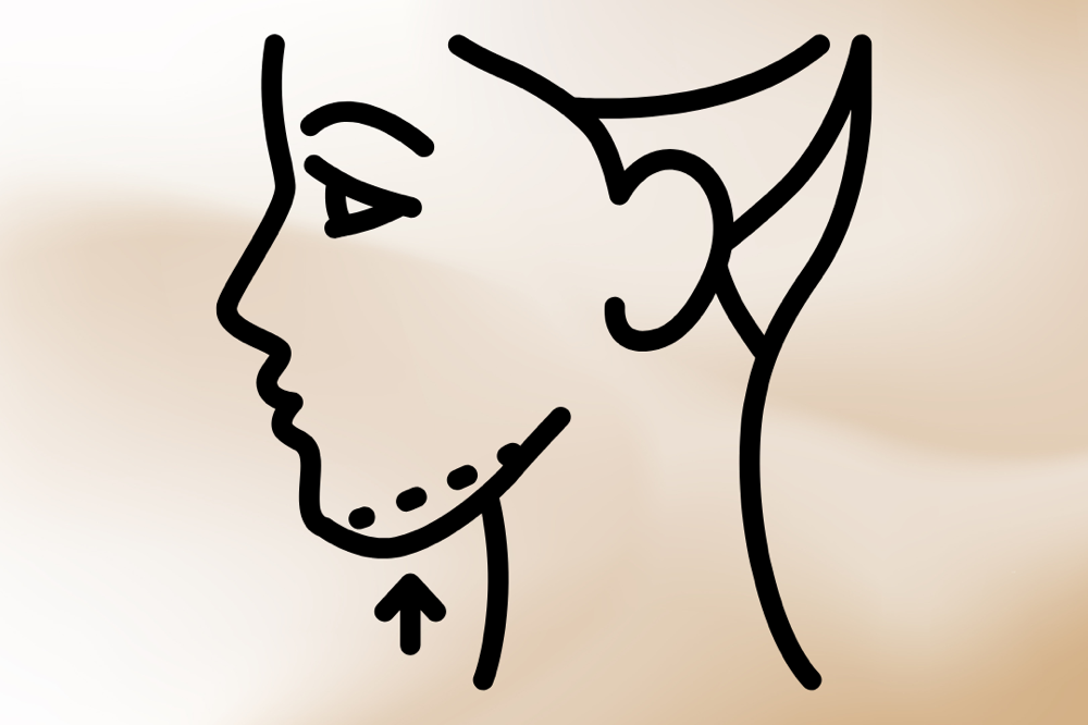 CHIN WAX