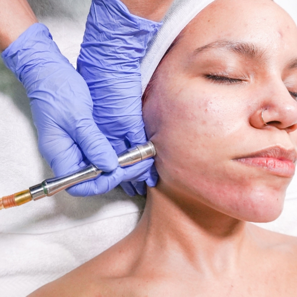 Porefectly Smooth Facial at Pore Decisions Esthetics LLC in Hinesville, GA