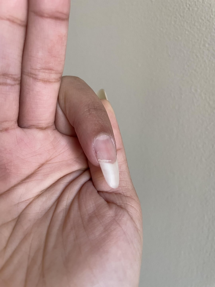 Nail Repair