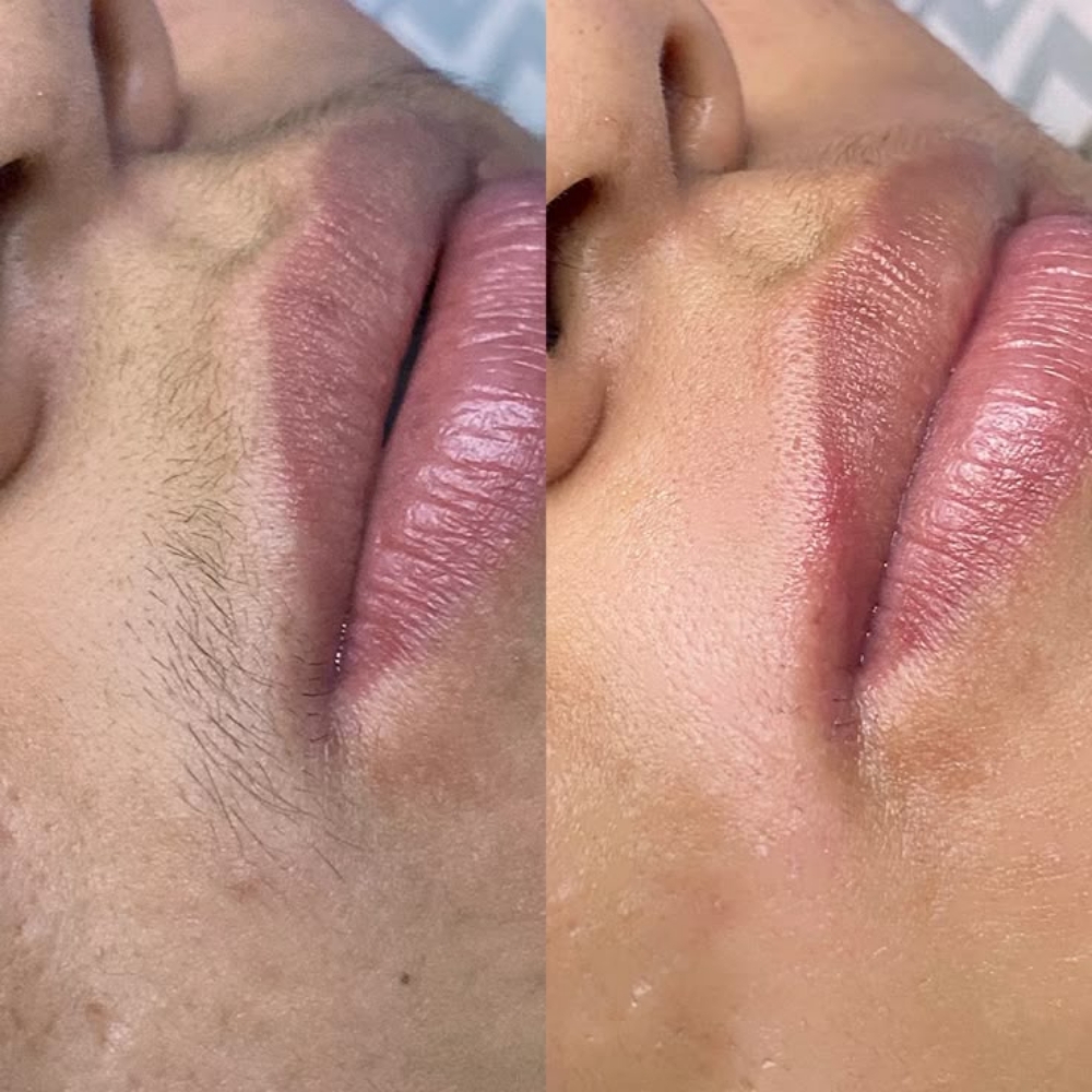 Lower Lip Wax at Entouch Day Spa  |   La Pine's Premier Facial Spa & Waxing Studio in La Pine, OR
