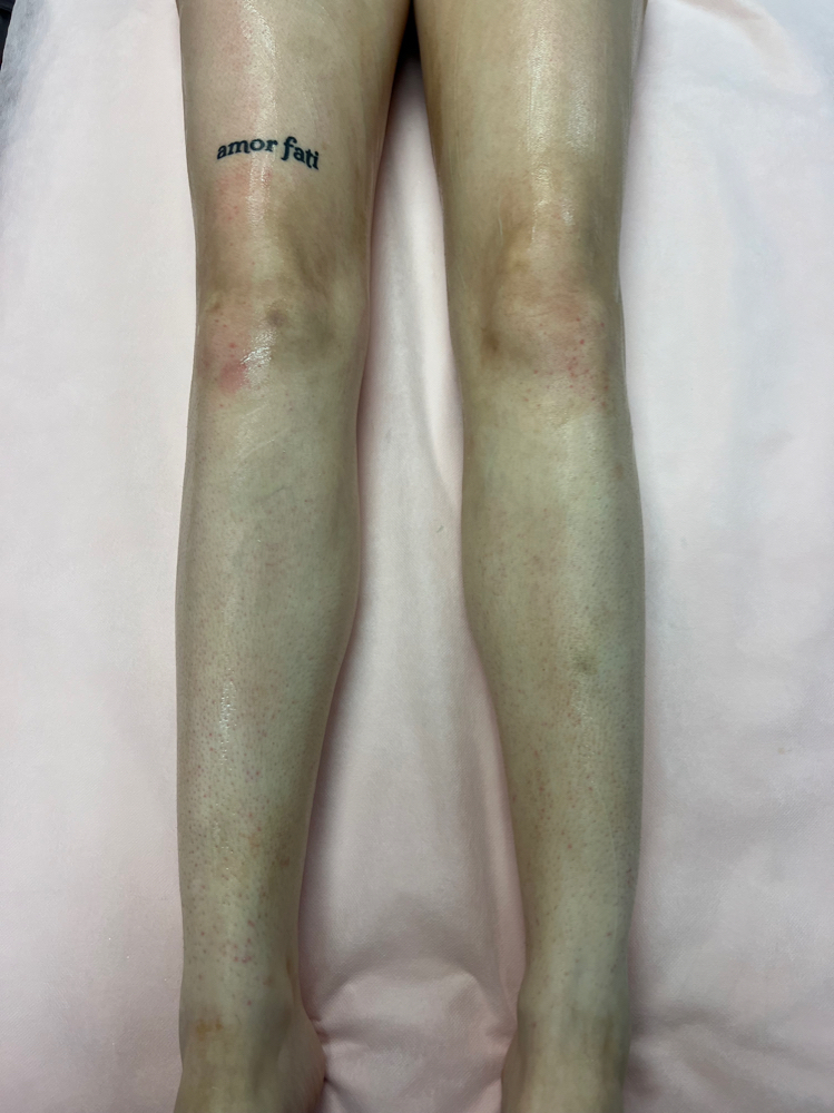 Full Leg Wax