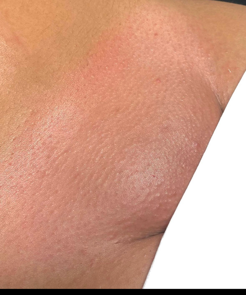 Brazilian Wax