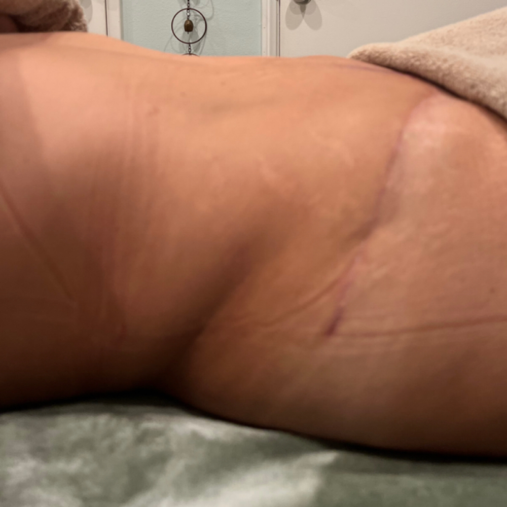 Body Sculpting at The Spa Unicorn By appointment only in Claremont, CA