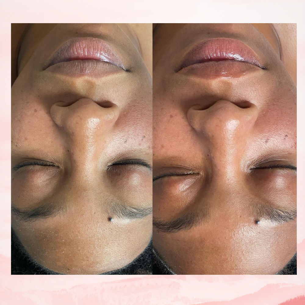 Customized Facial