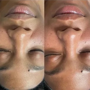 Healthy Skin Facial at Gleam Glitz Glow in Las Vegas, NV