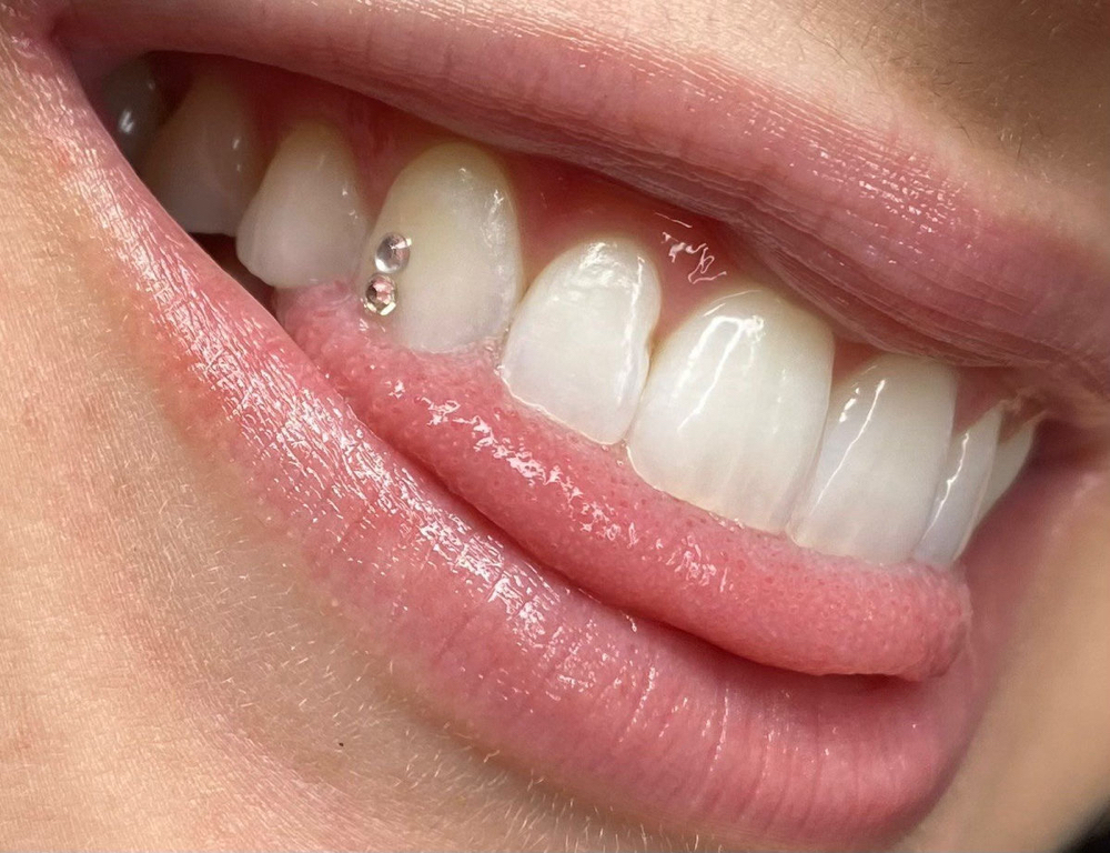 Tooth Gems at The Naked Berry in Madera, CA