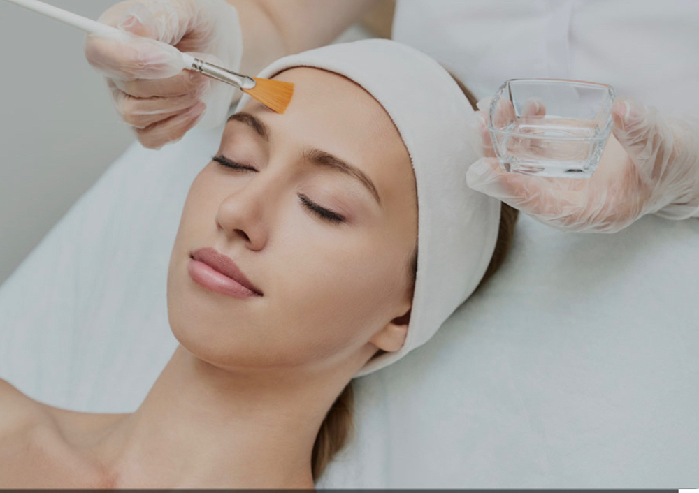 Chemical Peel
