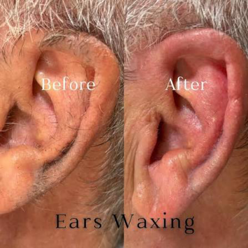 Ears Wax at True Beauty Esthetics in Lufkin, TX