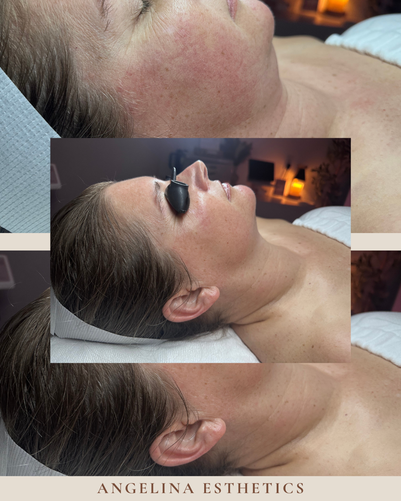 60 Minute Facial – Focused Care