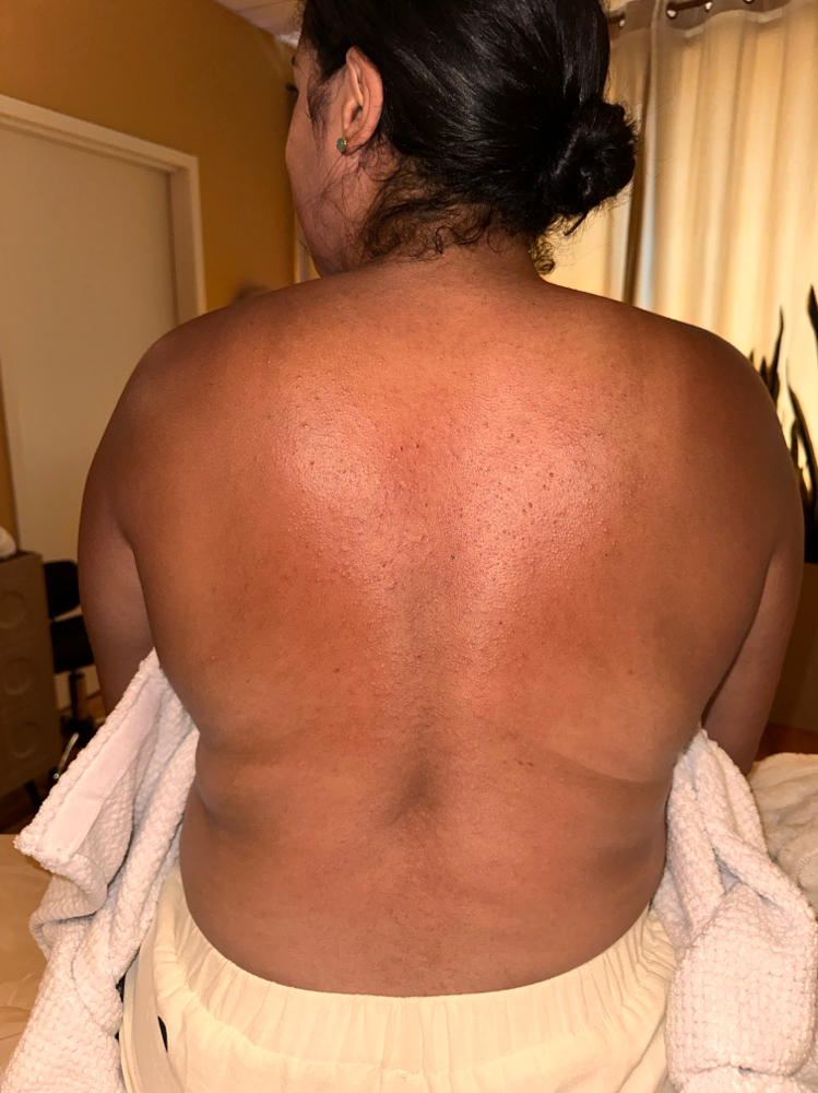 ✨ Custom Back Facial