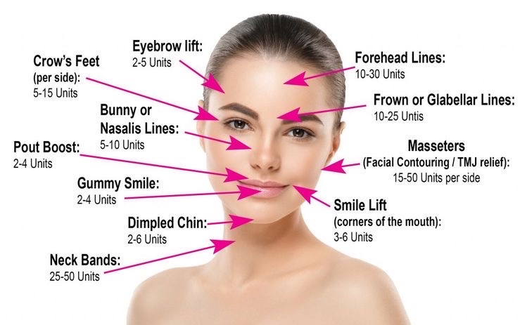 Botox