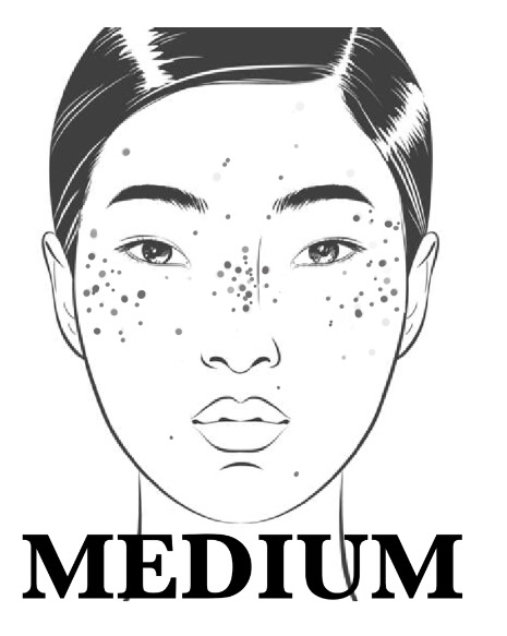 Freckles -Medium coverage