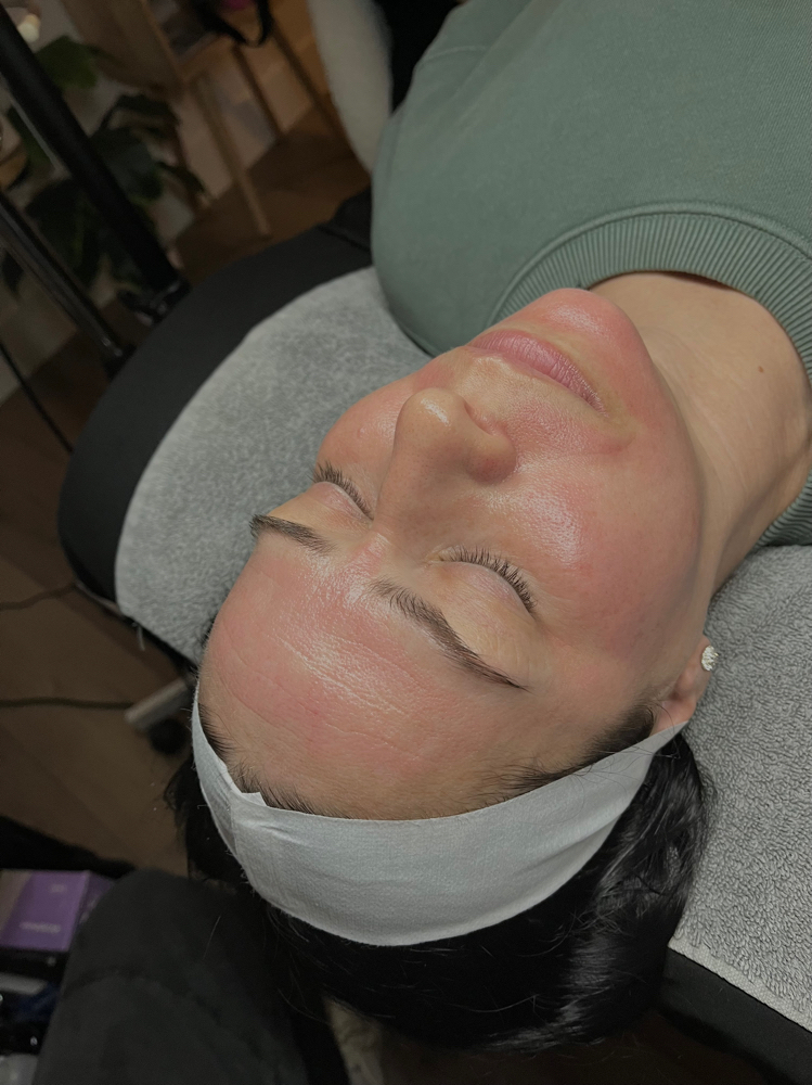 Package Of 3 Chemical Peels