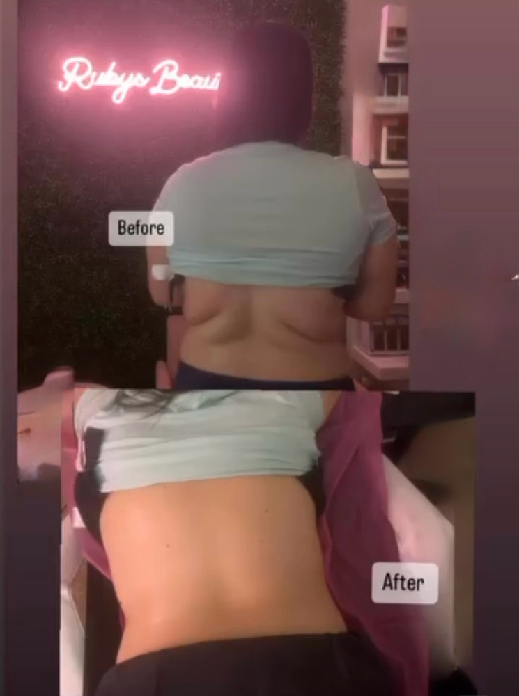 Slimming Session
