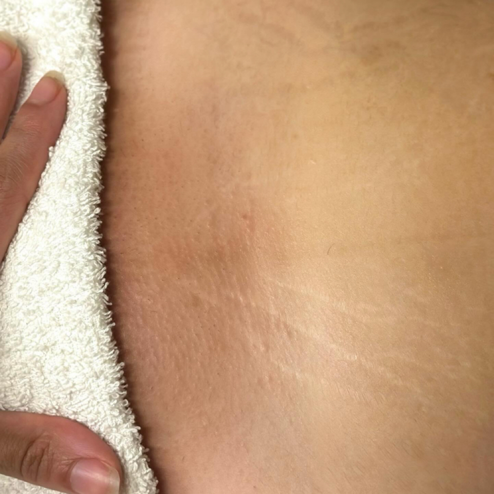 Brazilian Waxing at Skin Academy in New Bedford, MA