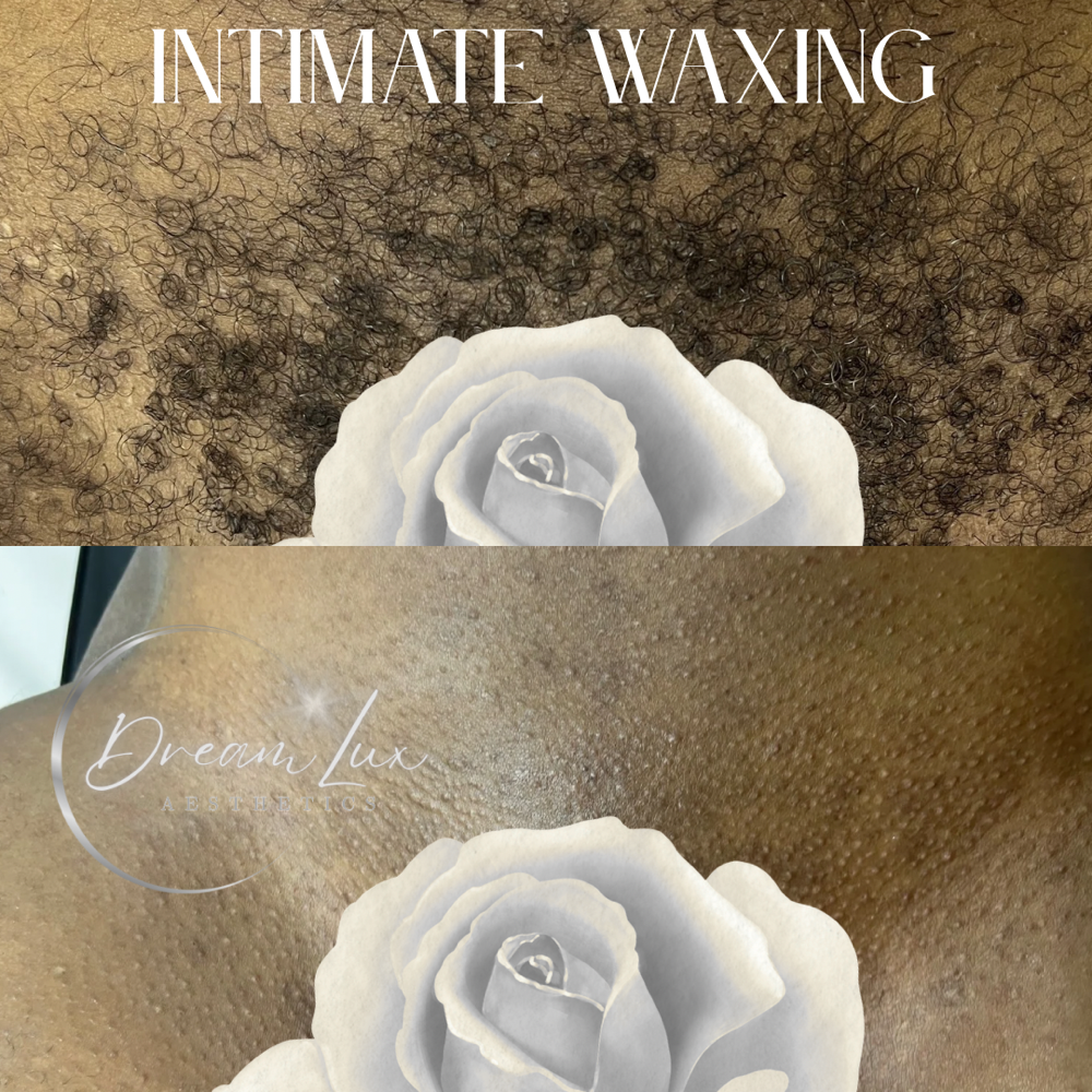 Intimate Waxing