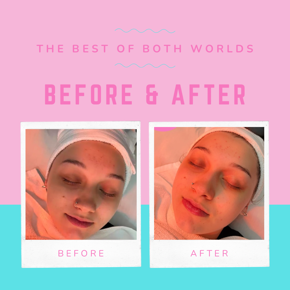 Hydration “Refresh” Facial