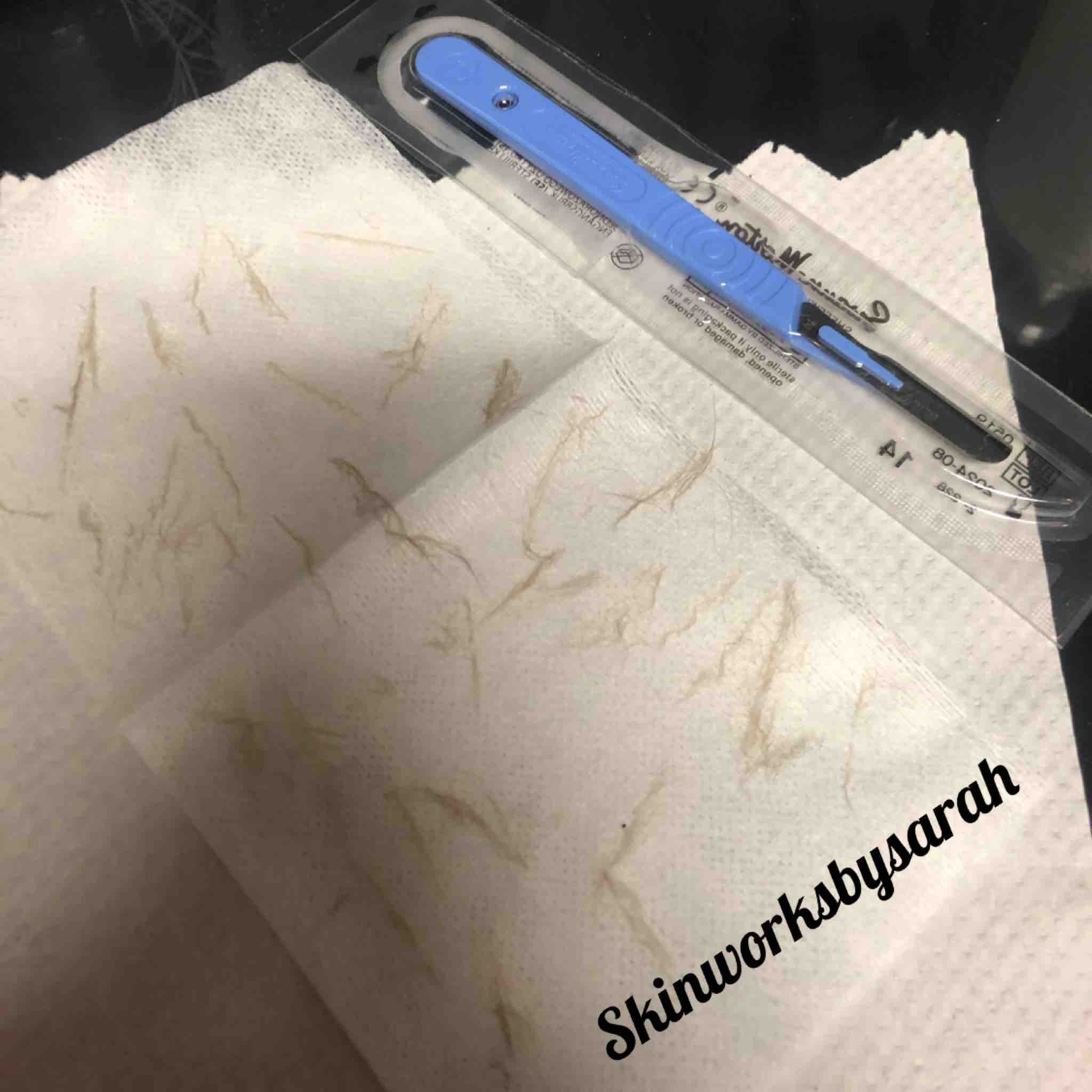 Dermaplaning
