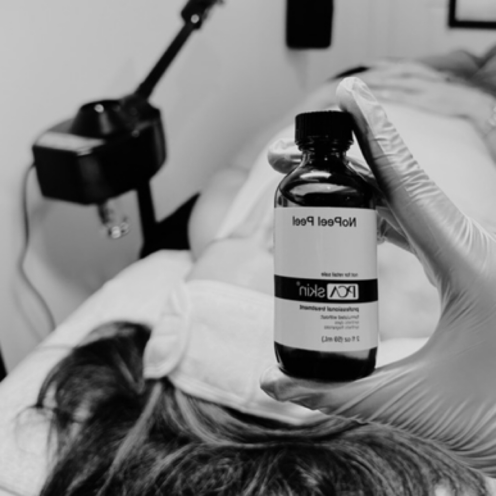 Chemical Peels at Bare Aesthetics By Chloe in Lake Norman of Catawba, NC